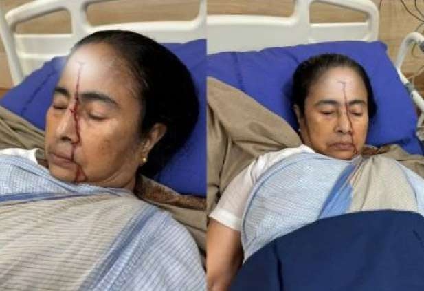 1_1710444685-mamata-banerjee-injured-mamata.jpg